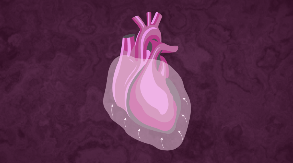 Pericardial Effusion Blog Header Image